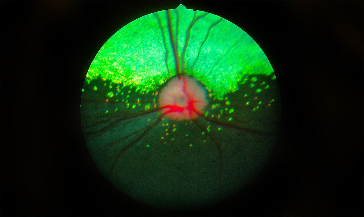 Gene Therapy “Cures” Dog Blindness Again